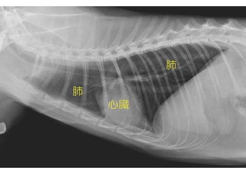 肺 に 水 が 溜まる 病気